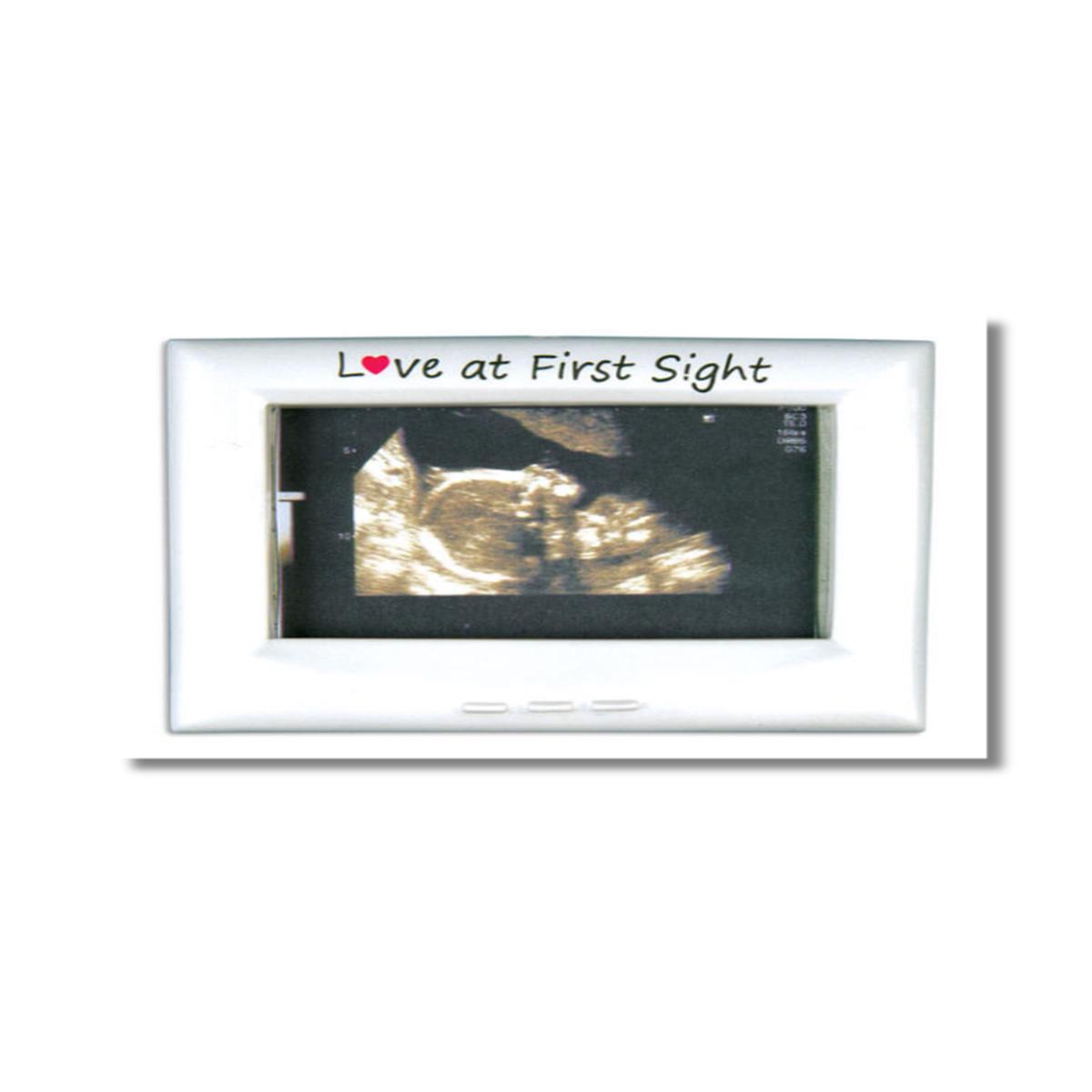 3 Inch Ultrasound Frame Customizable Ornament  A Beautiful First Memory Youll Cherish Forever