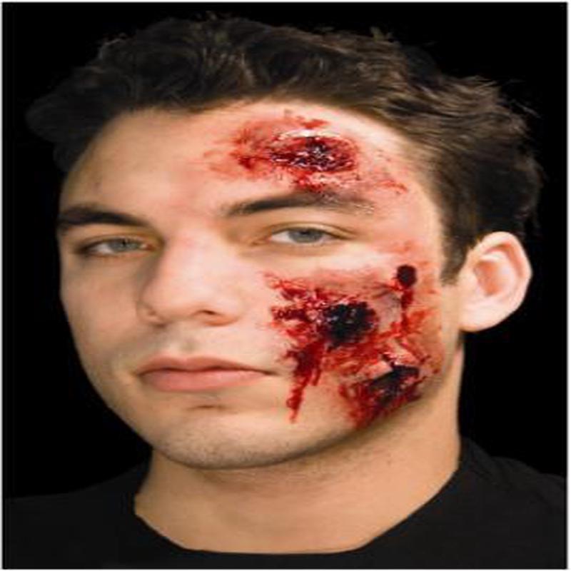 Capped Prosthetics